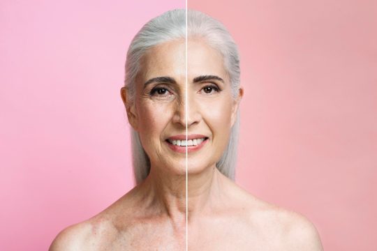 Before and after portrait of mature woman retouched