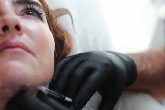 Close-up of a Woman During an Aesthetic Medicine Procedure 